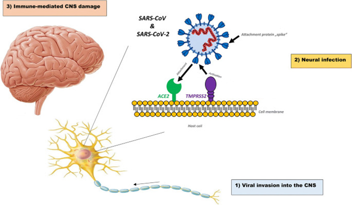 Tổn thương trên thần kinh của Sars-cov-2