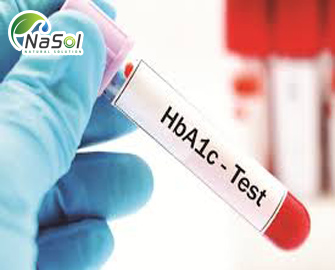 Xét nghiệm HbA1C quan trọng thế nào với bệnh tiểu đường 